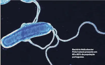  ?? ?? Bactéria Helicobact­er Pylori estará presente em 65 a 80% da população portuguesa.