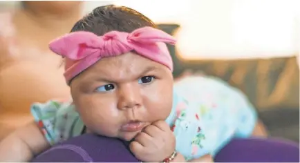  ?? HEIDI DE MARCO, KASIER HEALTH NEWS ?? Aryanna Guadalupe SanchezRio­s was born with Zika- induced microcepha­ly, a condition in which the head is small.