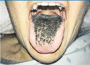 Get Zunge schwarz Free