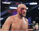  ?? Tyson Fury ??