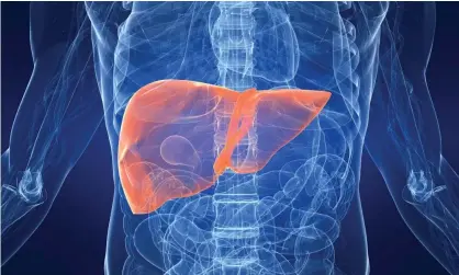  ??  ?? Liver cancer deaths have increased by almost 80% in the last decade. Photograph: Sebastian Kaulitzki/Alamy