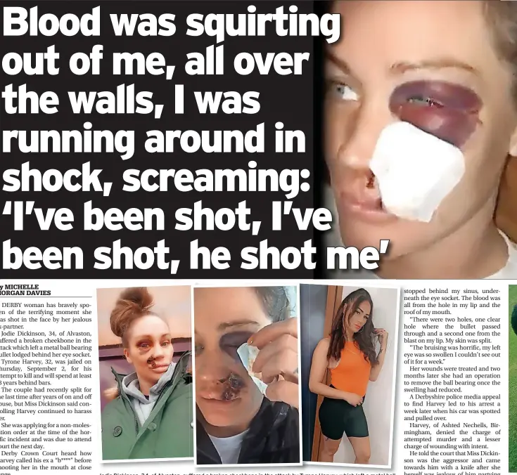  ??  ?? Jodie Dickinson, 34, of Alvaston, suffered a broken cheekbone in the attack by Tyrone Harvey, which left a metal ball bearing bullet lodged behind her eye socket. She is still recovering from her ordeal