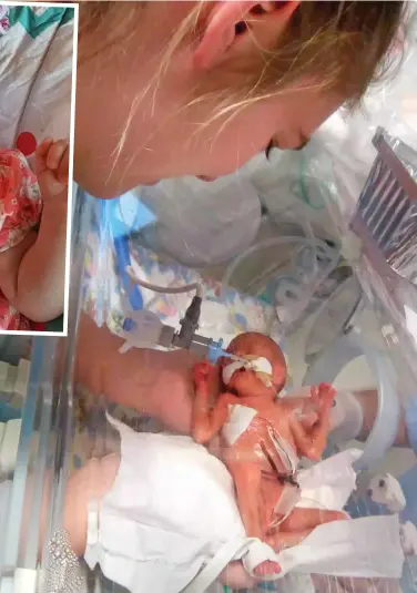  ??  ?? Survivor: Hailie was born at 23 weeks and six days, and spent three months in hospital