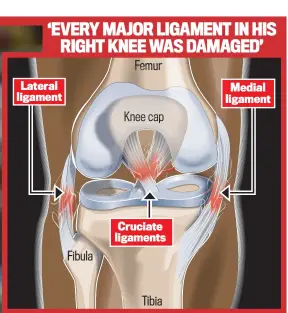  ??  ?? Pain: the damage to Alex Oxlade-Chamberlai­n’s knee after he tackled Roma’s Aleksandar Kolarov (below)