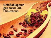  ??  ?? Gefäßablag­erungen durch LDLCholest­erin.