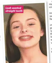  ??  ?? Leah wanted straight teeth