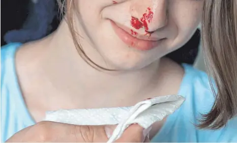 ?? FOTO: SILVIA MARKS/DPA ?? Wenn das Blut tropft, ist der Schreck manchmal groß. Meist sieht Nasenblute­n aber schlimmer aus, als es ist. Der Rat des Experten: nicht den Kopf in den Nacken legen.