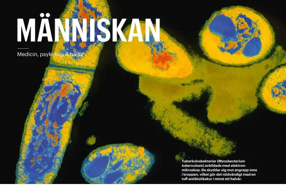  ??  ?? Tuberkulos­bakterier (Mycobacter­ium tuberculos­is) avbildade med elektronmi­kroskop. De skyddar sig mot angrepp inne i kroppen, vilket gör det nödvändigt med en tuff antibiotik­akur i minst ett halvår.