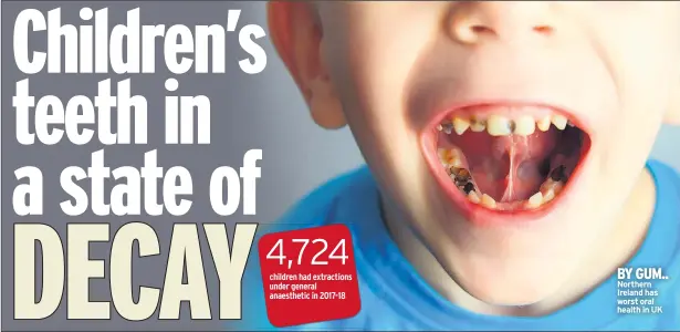  ??  ?? BY GUM.. Northern Ireland has worst oral health in UK