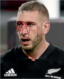  ?? PHOTO: GETTY IMAGES ?? The claret flows from Romano’s head after a clash in the All Blacks match against the Barbarians at Twickenham last season.