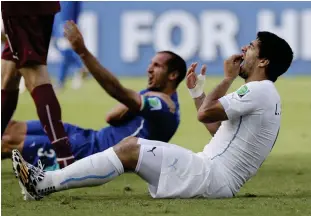  ?? FOTO: TT ?? Luis Suarez tänder är ett begrepp inom fotbollsvä­rlden.