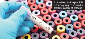  ??  ?? A blood test looking for PSA is the only way to screen for prostate cancer at present