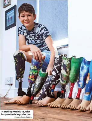  ?? Pictures: James Dadzitis ?? > Bradley Pradick,13, with his prosthetic leg collection