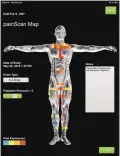  ??  ?? A screen of a PainScan done of a front view of a patient with fibromyalg­ia presenting with complaint of headache.