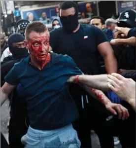  ??  ?? Blood pours down the face of this protester at Waterloo Station