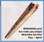  ??  ?? SEBAHAGIAN paruh ikan todak yang berjaya dikeluarka­n dari leher
Pope. - Agensi