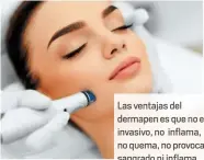  ??  ?? Las ventajas del dermapen es que no es invasivo, no inflama, no quema, no provoca sangrado ni inflama