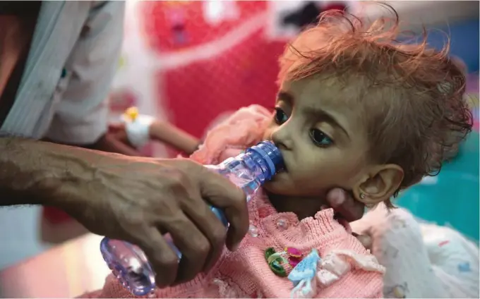  ?? FOTO: AP/NTB SCANPIX ?? FN FRYKTER HUNGERSNØD: En far gir vann til sin undeernaer­te datter på et sykehus i Hodeida i Jemen, der tolv millioner mennesker kan stå i fare for å sulte i hjel.
