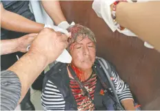  ??  ?? En medio de las pedradas entre policías y migrantes, María de Jesús Peters, reportera de EL UNIVERSAL, resultó herida y tuvo que ser atendida.