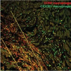  ?? PHOTO: ?? In this microscopi­c histology image, macrophage immune cells (shown in red and green) flock to the injured region of a damaged mouse heart three days after researcher­s injected adult heart stem cells within the yellow dotted area. Researcher­s report Nov. 27 in Nature that stem cell therapy helps hearts recover from heart attack by triggering an innate immune response that alters cell activity around the injured area so that it heals with a more optimized scar and improved contractil­e properties.
Cincinnati Children’s