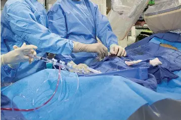  ?? AP Photo/Mark Lennihan ?? ■ In this Feb. 16, 2017, file photo, surgeons perform a non-emergency angioplast­y at Mount Sinai Hospital in New York. Through a blood vessel in the groin, a tube is guided to a blockage in the heart. A tiny balloon is then inflated to flatten the clog, and a mesh tube called a stent is inserted to prop the artery open. According to a federally funded study released on Saturday, people with severe but stable heart disease from clogged arteries may have less chest pain if they get a procedure to improve blood flow rather than just giving medicines a chance to help, but it won't cut their risk of having a heart attack or dying over the following few years.