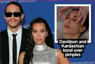  ?? ?? Davidson and Kardashian bond over pimples