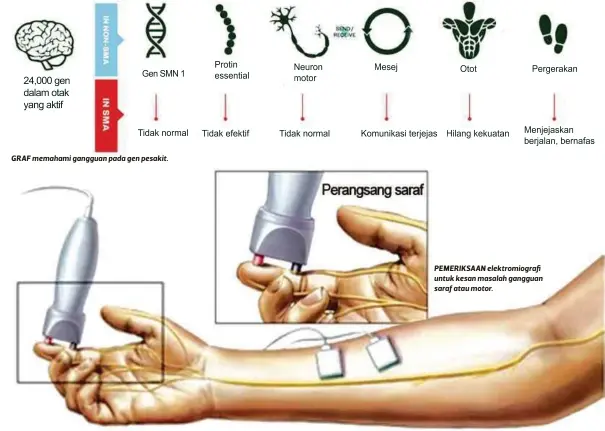 ??  ?? GRAF memahami gangguan pada gen pesakit. PEMERIKSAA­N elektromio­grafi untuk kesan masalah gangguan saraf atau motor.