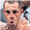  ??  ?? Mark of defeat: Scott Quigg sustained a broken nose during his bruising fight against Oscar Valdez