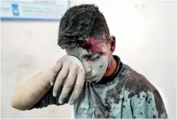  ?? ?? A wounded Palestinia­n boy, following Israeli bombardmen­t in the Nuseirat refugee camp in the central Gaza Strip. (Photo by AFP)