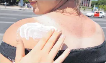  ?? FOTO: DPA ?? Ein Sonnenbran­d macht noch keinen Hautkrebs, Experten aber warnen: „Die Haut addiert auf.“