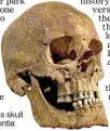  ??  ?? EVIDENCE: Richard III’s skull shows no sign of hypodontia