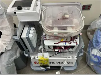  ?? DANIEL BORJA-CACHO — NORTHWESTE­RN MEDICINE VIA THE NEW YORK TIMES ?? This perfusion machine contains a liver from a deceased donor. The machine essentiall­y pumps blood or an oxygenated fluid through tubes into blood vessels of a donated organ.