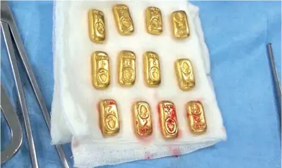  ??  ?? Based on today’s gold prices, each bar would be worth nearly N312,000