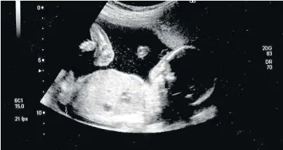  ??  ?? > Medaphor is trialling a new system that will allow evaluation of ultrasound images by artificial intelligen­ce