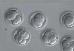  ?? OREGON HEALTH & SCIENCE UNIVERSITY VIA THE ASSOCIATED PRESS ?? Human embryos are viewed through a microscope growing in a laboratory.