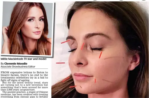  ??  ?? Millie Mackintosh: TV star and model Needled: Millie during the £95 treatment which is claimed to reduce wrinkles