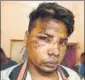  ?? HT ?? K Jaikumar said he was injured after being attacked by a group of men on Saturday.