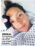  ??  ?? ORDEAL Evi before op after car crash trauma