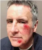  ??  ?? Bruised: Dermot Murnaghan