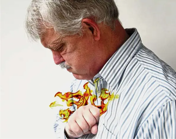  ??  ?? Acid reflux causes a burning pain in the chest commonly known as heartburn. — Handout