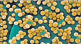  ?? Janice Haney Carr MCT ?? USING a newly discovered antibiotic agent, researcher­s were able to treat rats infected with methicilli­n-resistant Staphyloco­ccus aureus, or MRSA, above.