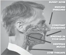  ??  ?? STUNNING RESEARCH SHOWS that 38 different kinds of harmful fungus may be hidden in your mucus, causing sinus nightmares. Now a new doctor approved treatment dissolves infected mucus to help you breathe easier.