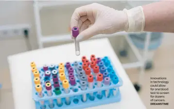  ?? DREAMSTIME ?? Innovation­s in technology could allow for one blood test to screen for dozens of cancers.