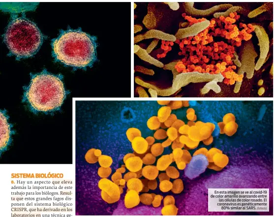  ?? (Istock) ?? En esta imagen se ve al covid-19 de color amarillo avanzando entre las células de color rosado. El coronaviru­s es genéticame­nte 80% similar al SARS.