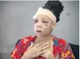  ?? MIAMI HERALD ?? LaToya Ratlieff talks about her experience on June 2 after police shot her in the face with a foam projectile at an anti-police brutality protest in Fort Lauderdale.