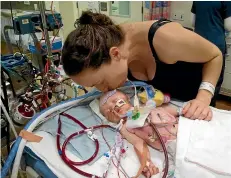  ??  ?? Harri Brown at the paediatric intensive care unit just after he was born and had openheart surgery.