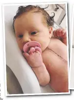  ??  ?? LITTLE FIGHTER: Haddie Filisetti has had a tough start to life, showing the scars of two open heart surgeries since she came into the world just seven weeks ago.