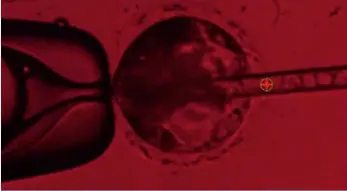  ??  ?? ¿Donantes forzosos?El año pasado, científico­s de la Universida­d de California en Davis inyectaron células madre humanas en un embrión porcino –arriba– y crearon un embrión mixto de ambas especies que estudiaron durante veintiocho días antes de destruirlo. El objetivo en el horizonte, si llega a ser legal: crear fetos de cerdo viables que alberguen órganos humanos para trasplante­s.