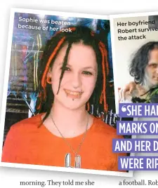  ??  ?? Sophie was
beaten because of her
look
Her boyfriend Robert survived the attack