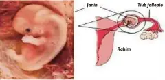  ??  ?? KEHAMILAN luar rahim berlaku di dalam tiub fallopio